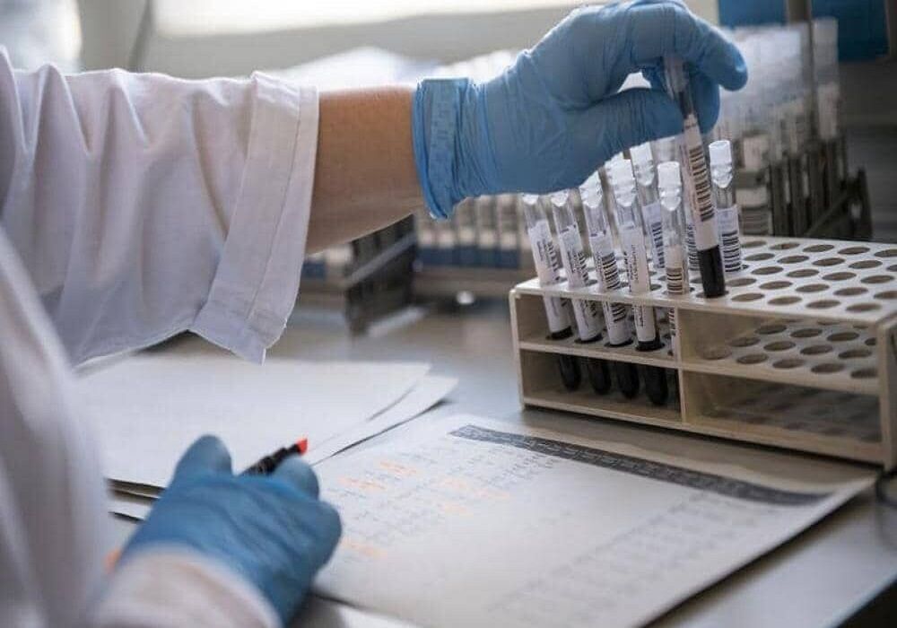 روزانه ۳۰۰ نمونه آزمایش کرونا در کردستان گرفته می&zwnj;شود